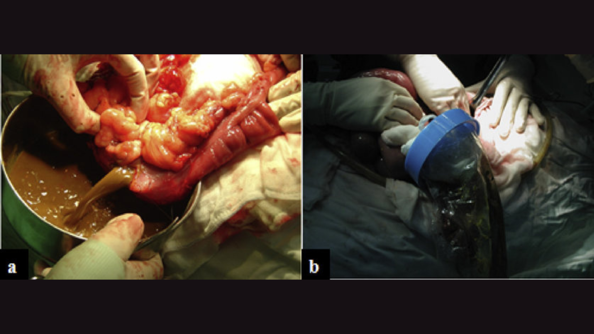 Physiotherapy & Rehabilitation